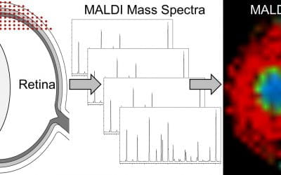 MALDI imaging of the eye